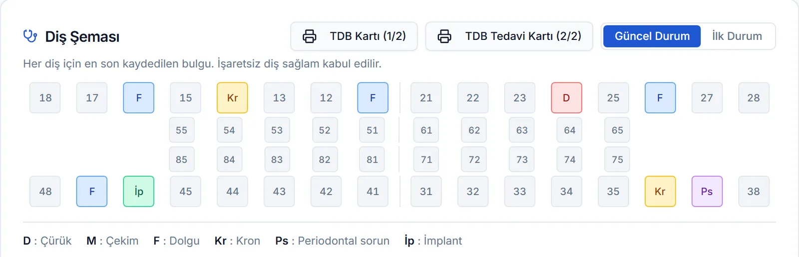 Diş şeması: dolgu, kron, çürük ve implant işaretli dişler